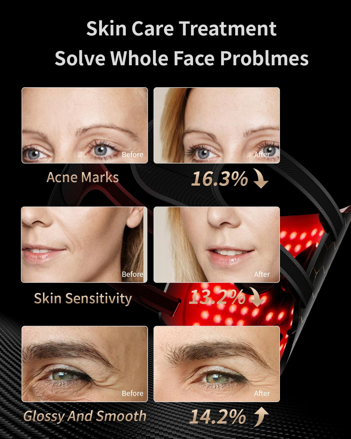 Face Mask Light 7 Colors: Anti-Aging Properties Black Face Mask